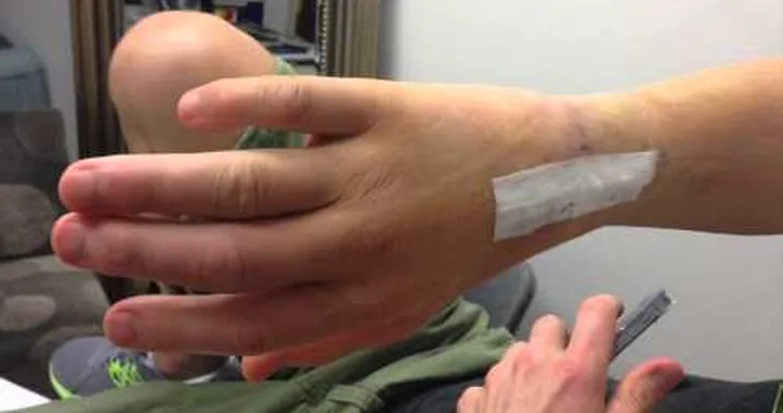 Nicky Hayden Undergoes Surgery