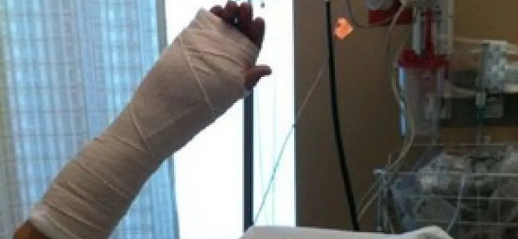 Nicky Hayden operato al polso