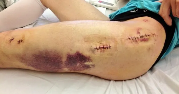 SBK: operazione riuscita per Rea, Camier tornerà in Turchia