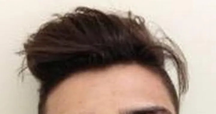 MotoGP: Andrea Iannone operato al naso