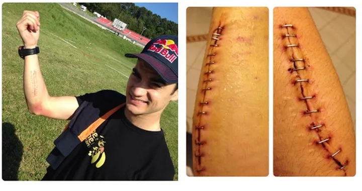 MotoGP: riposo e riabilitazione per Pedrosa