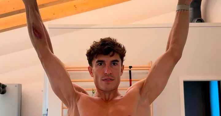 Marc Márquez, la foto in palestra svela i problemi alla spalla