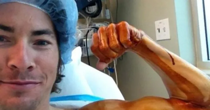 Nicky Hayden operato alla spalla con successo