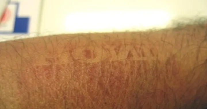 Foto del giorno: ho scritto Honda sul mio braccio...