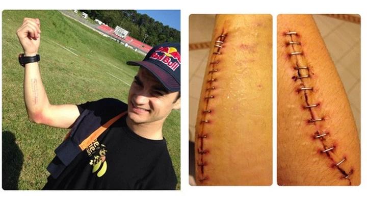 MotoGP: riposo e riabilitazione per Pedrosa