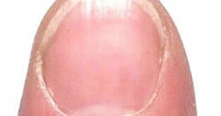 Un motore sull'unghia...