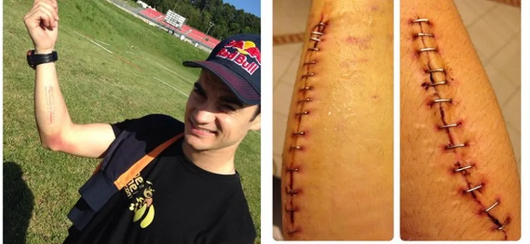 MotoGP: riposo e riabilitazione per Pedrosa