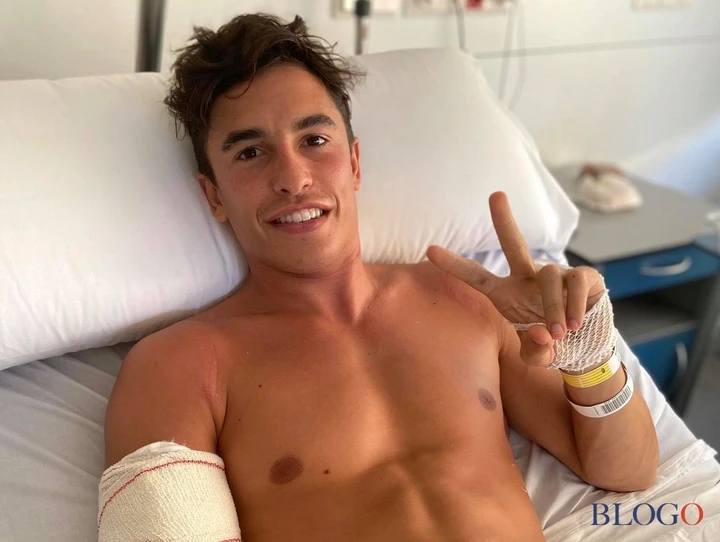 Marc Marquez e la seconda operazione: placca danneggiata. Salterà Brno